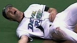 Tony Saunders - Fractured Arm