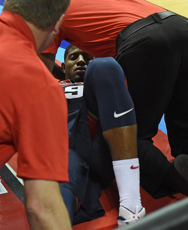 Paul George - Fractured Leg